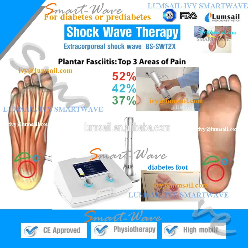 shock wave therapy for plantar fasciitis near me