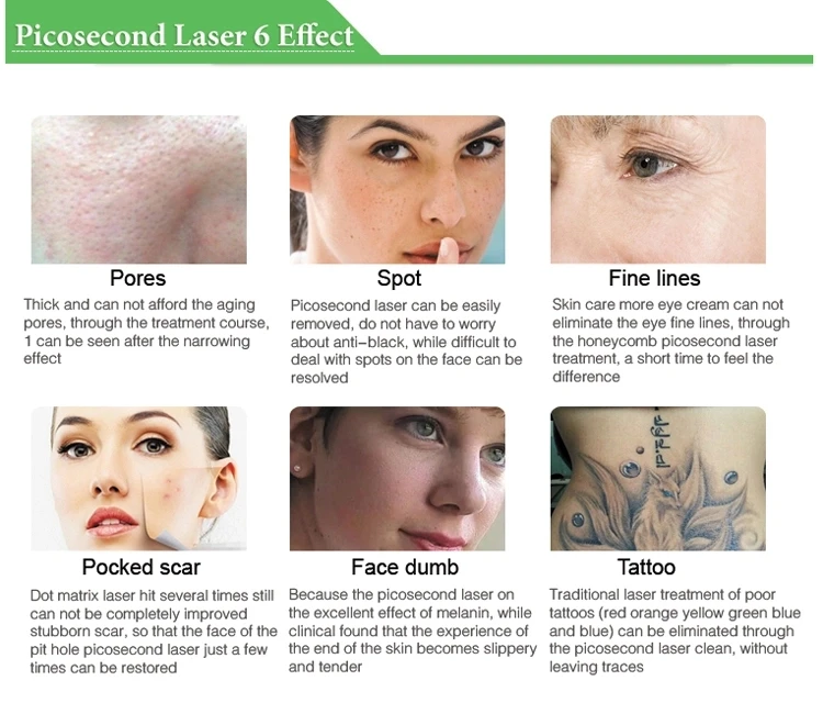 Tattoo removal Picosecond 532nm 755nm 1064nm Laser Removal Machine for Pigmentation