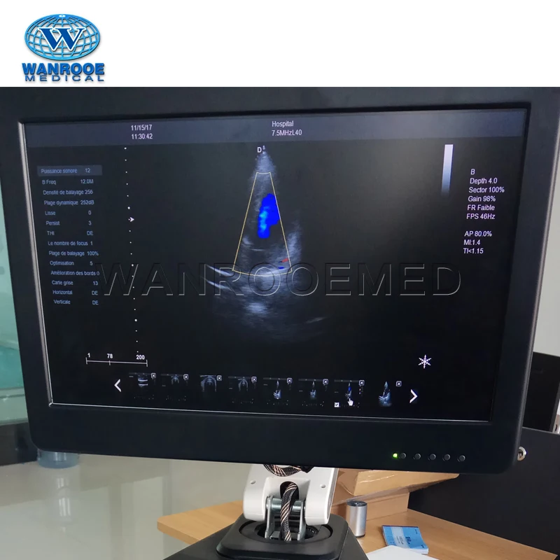 
USC80 Plus China Hospital Equipment Color 4D Digital Doppler Ultrasound Scanner Machine Price 