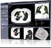 Advanced visualization software for Lung