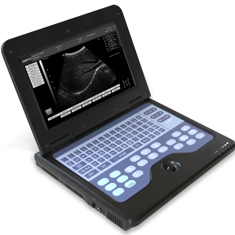 
Real manufacturer CONTEC CMS600P2 portable b ultrasound machine  (60700150198)
