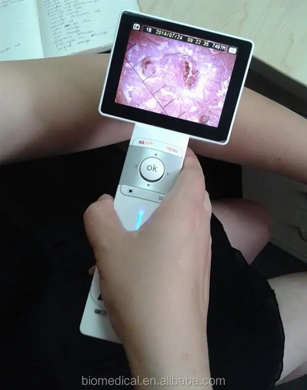 Otoscope Video Camera 