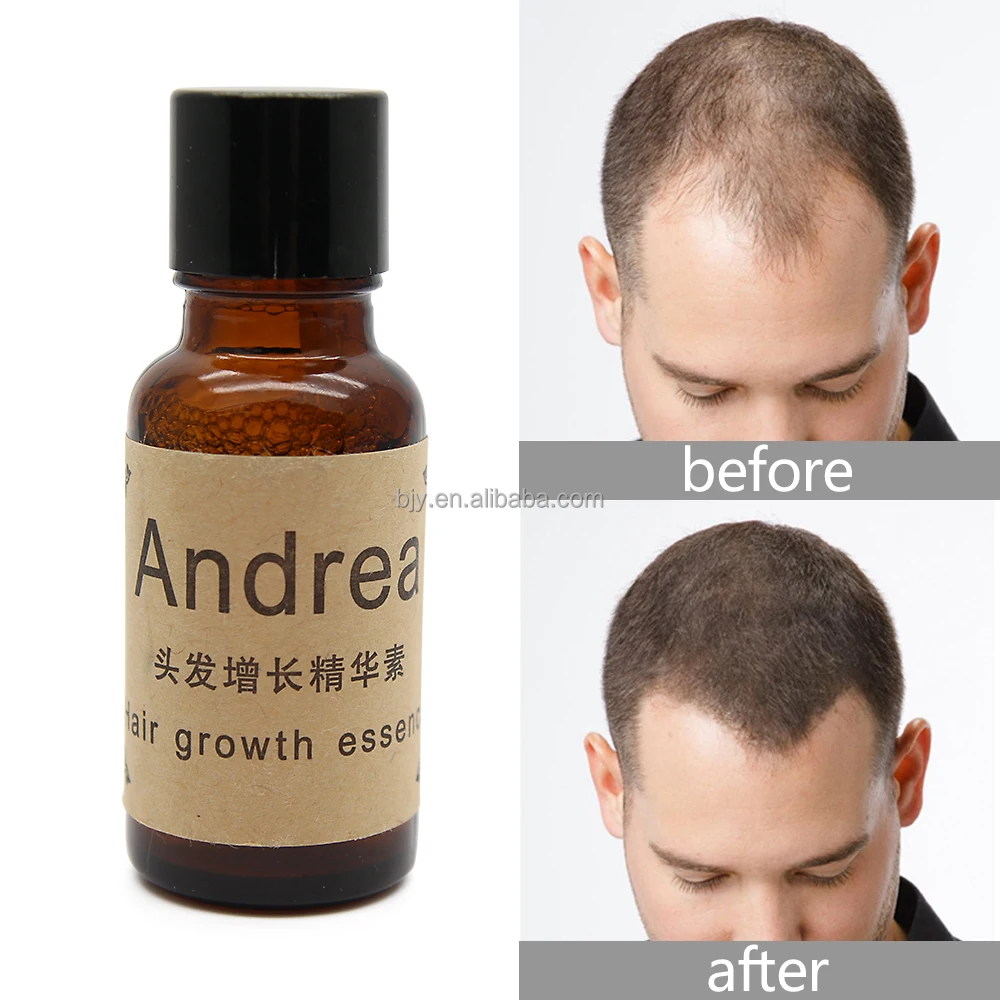 

Hot Selling 20ml Natural Effective Hair Growth Essential Oil Men For Hair Loss Treatment