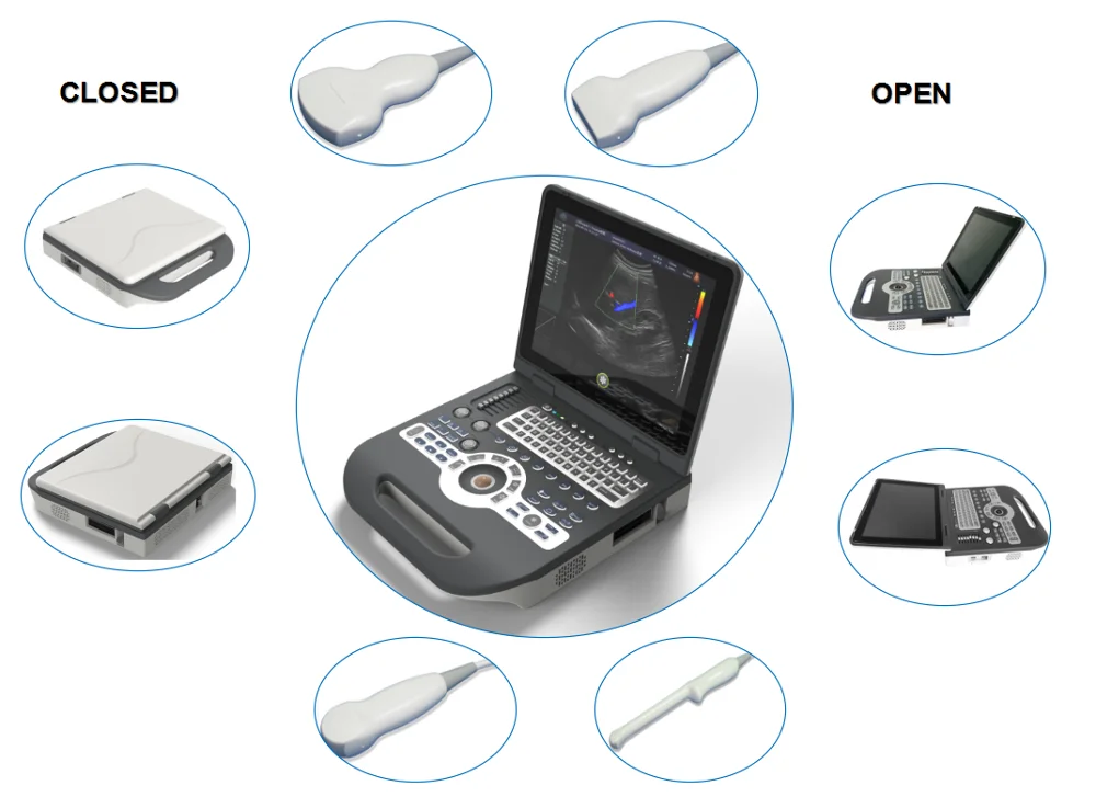 3d/4d Colourful Portable Echo Doppler Medical Cheap Ultrasound Machine