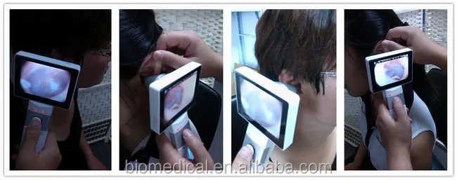 Otoscope Video Camera 