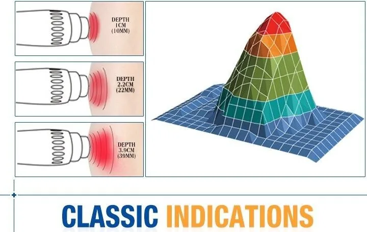 SW11 shockwave therapy equipment/shockwave machine and short wave diathermy