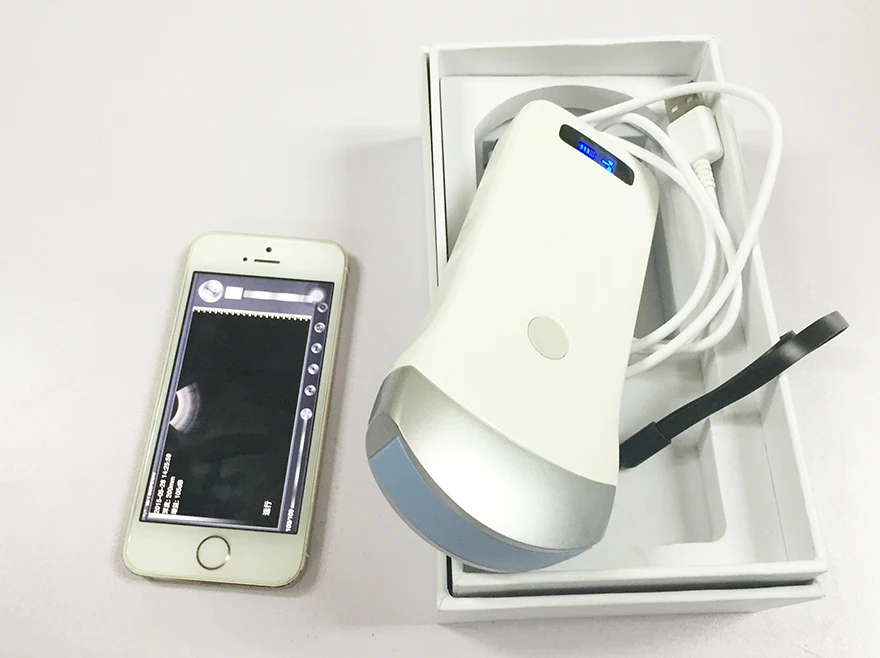 Iphone Ipad Android Wireless Ultrasound Probe Scanner/wireless