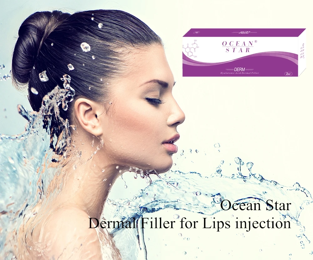 

2019 2ml Derm Ocean star dermal filler HA for lip enhancement, N/a