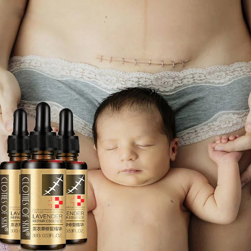 scar repair liquid (8).jpg