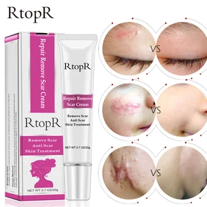 RtopR Acne Scar Stretch Marks Remover Cream Skin Repair Face Cream Acne Spots Acne Treatment Blackhead Whitening Cream Skin Care