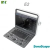 Ultrasound devices Sonoscape E1 doppler ultrasound scanner for human