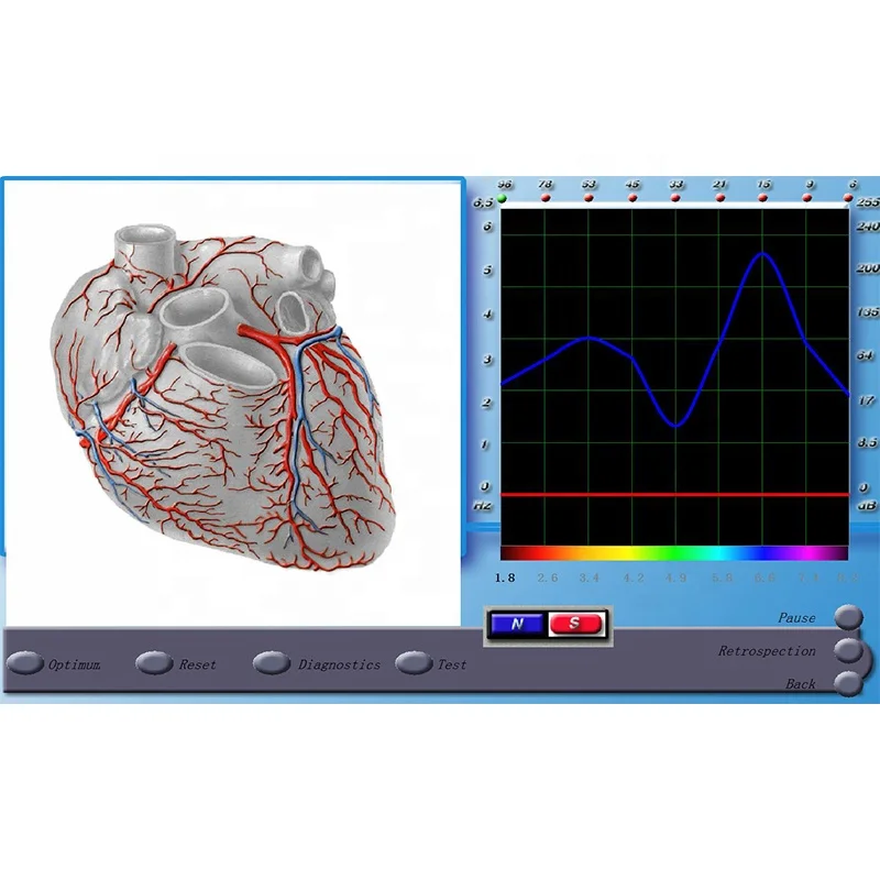
quantum resonance magnetic analyzer 3d nls 