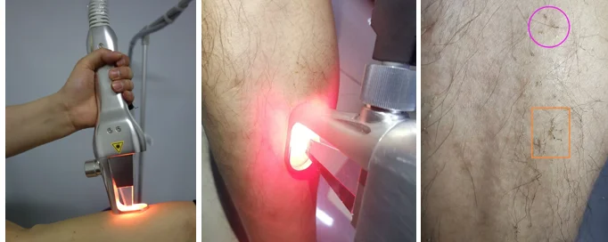 paste-pic-dp_uuid_1mgs6