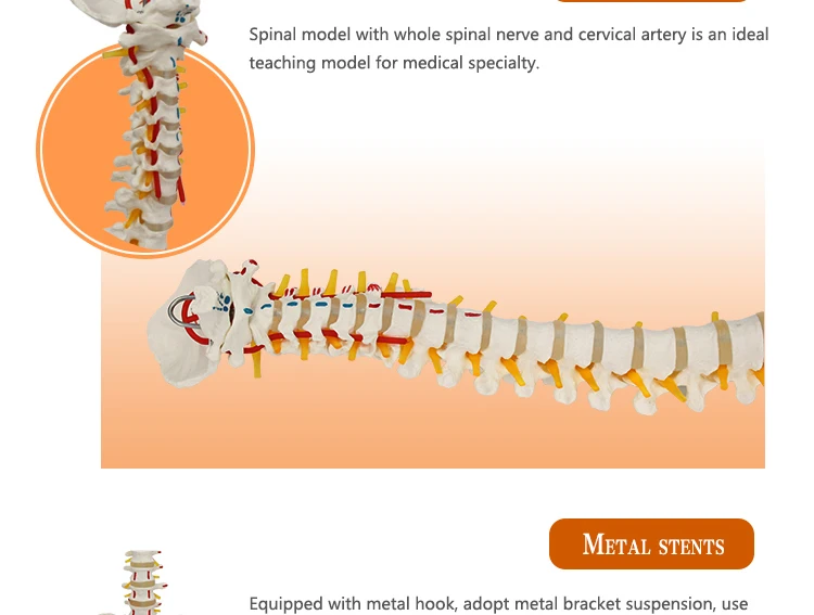 Spine 505 модель