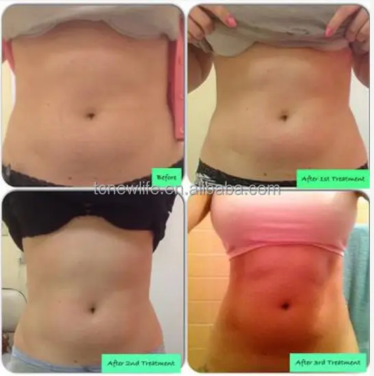 Cavitation effect RUV500-1