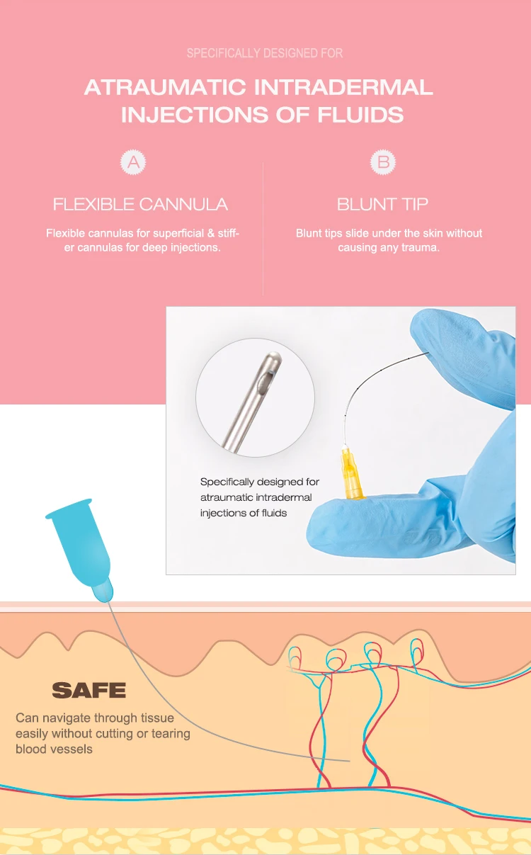 Chromic catgut absorbable suture with av fistula needle