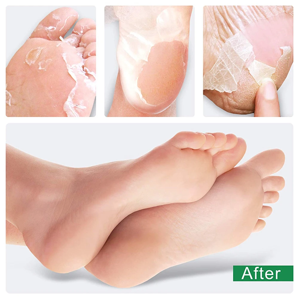 exfoliating magic foot