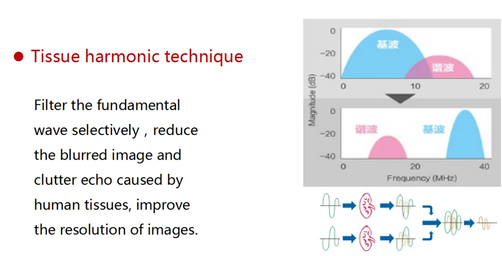 MT Medical Veterinary Ultrasound Machine