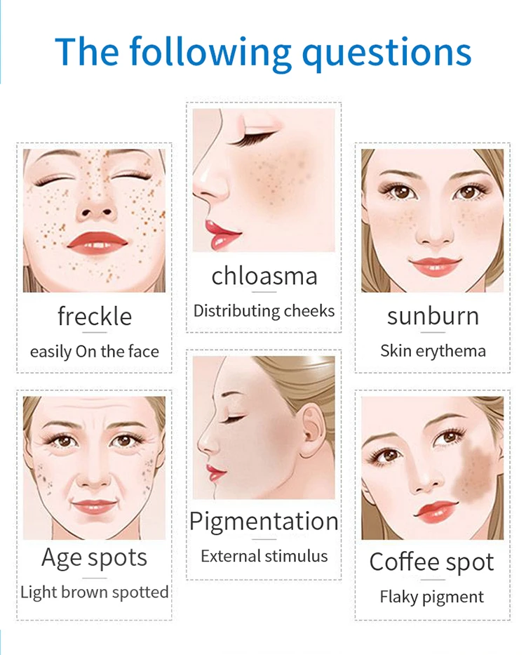 Freckle cream_03