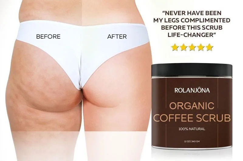 Rolanjona Cellulite Coffee Scrub Coffee Moisturizing Exfoliator For Oem View Best Exfoliating Body Scrub Rolanjona Product Details From Guangzhou Youxi Cosmetics Co Ltd On Alibaba Com