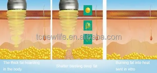 vacuun cavitation RUV500-1