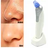 pore cleaner blackhead/comedo suction beauty vacuum blackhead remover machines equipment skin care set create your own brand