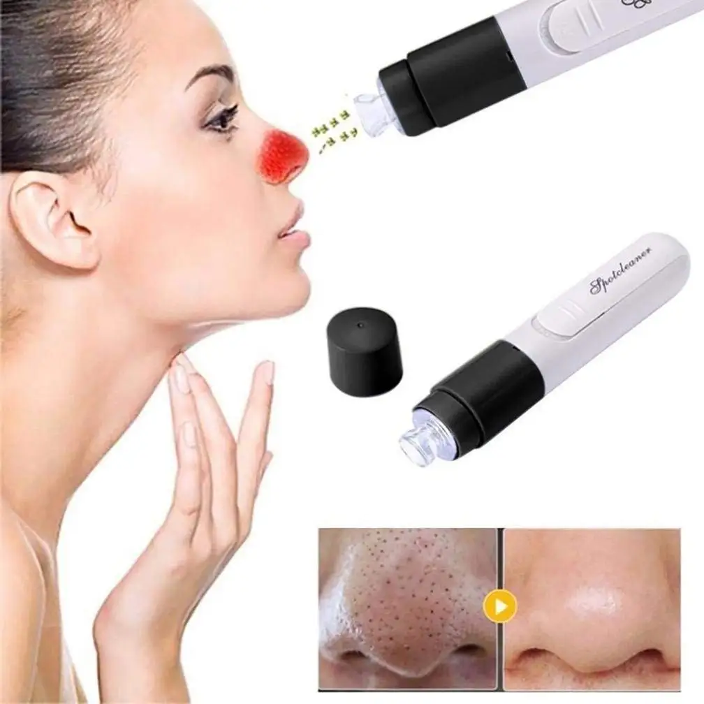 amazon blackhead suction