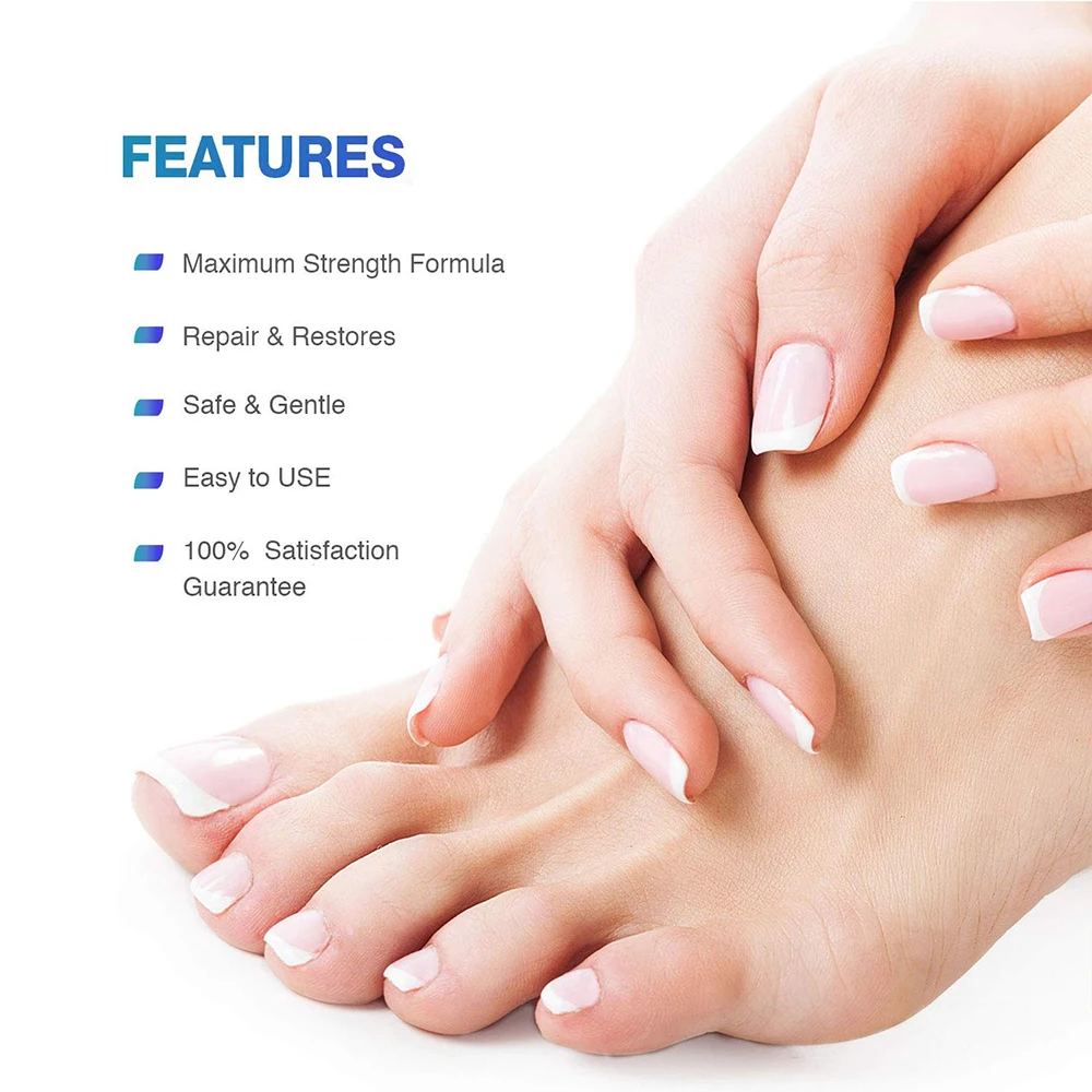 Nail Fungal Treatment Feet Care Essence Anti Infection Paronychia  Onychomycosis Nail Removal Foot Products Nail Toe Fungus S9h4| AliExpress |  Nail Treatments Essence Fungal Removal Anti Infection Paronychia  Anti-infective Nail Onychomycosis Repair
