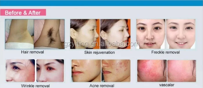 before and after.jpg