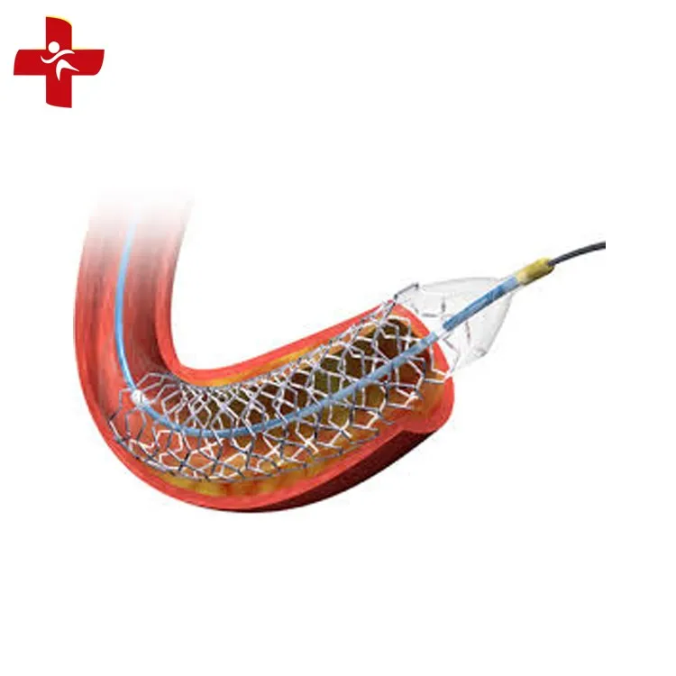 Коронарный стент. Sirolimus стент. Orsiro стент. Медицинские стенты для сосудов.