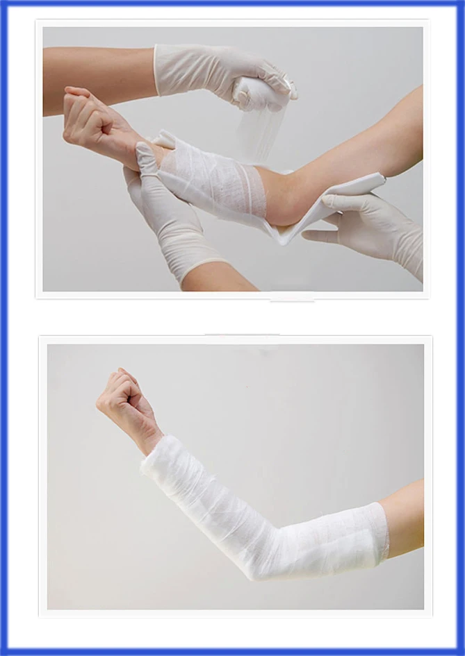 2018 Hot Sale Fiberglass Cast Splint Orthopedic Casting Tape Buy