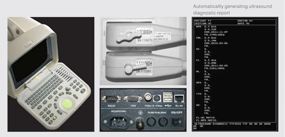 Portable Devices Micro-convex Ultrasonic Scanner Ultrasonic Diagnostic Scanner