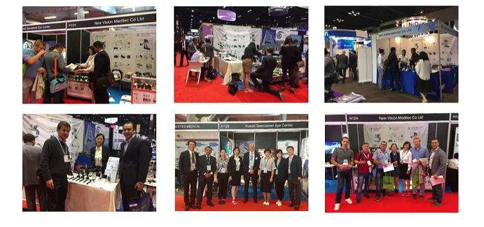 YZ5T Digital Slit Lamp with Digital Imaging Solution and Professional Software