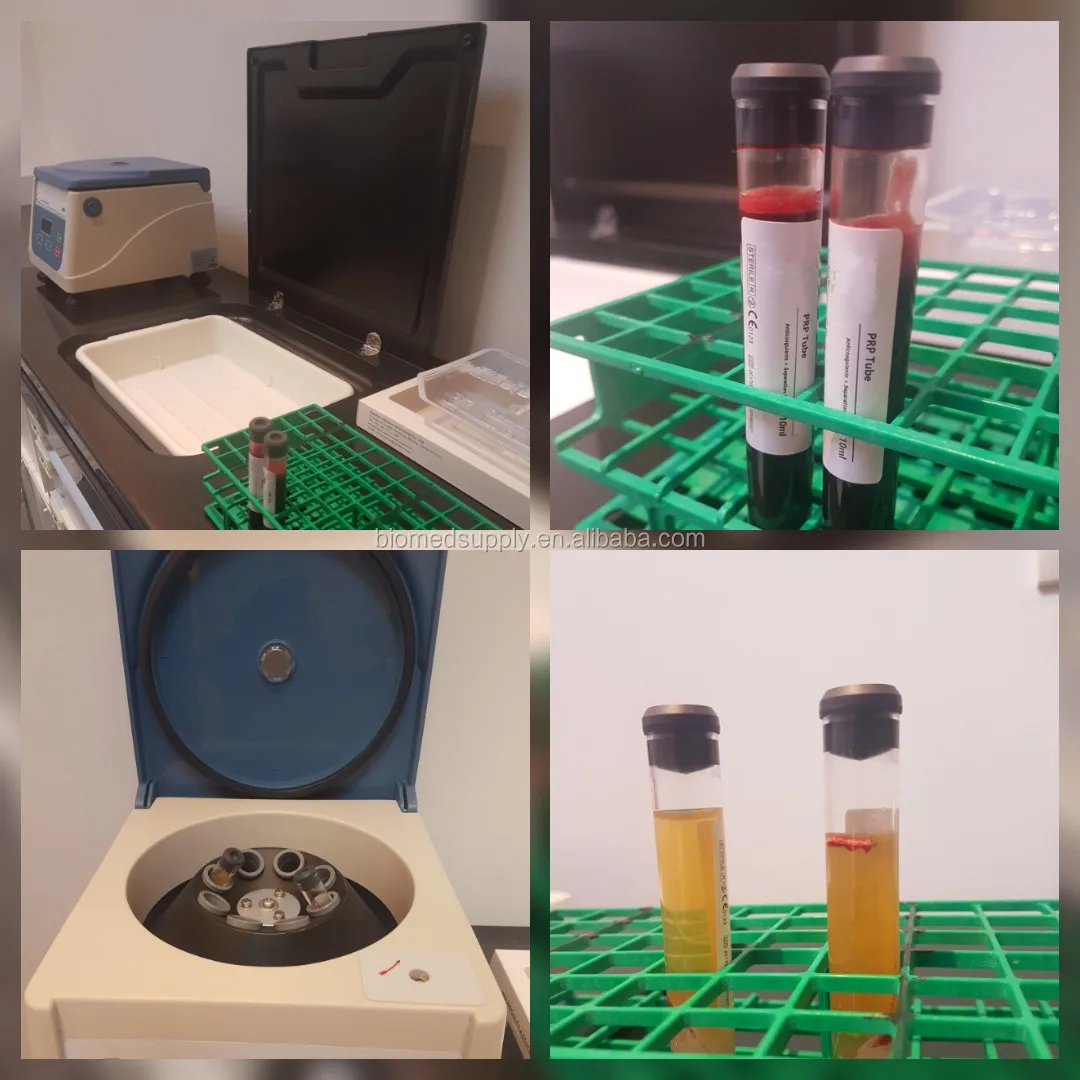 Bemedikprp Oem 12ml Platelet Rich Plasma Prp Tube With Acd Gel For Hair