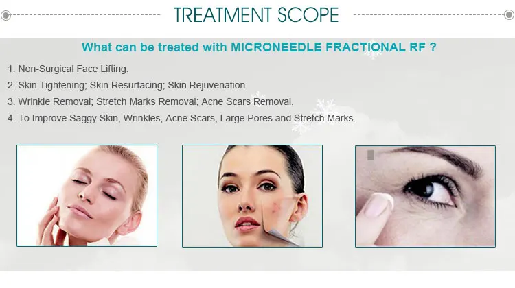 Treatment-scope.jpg