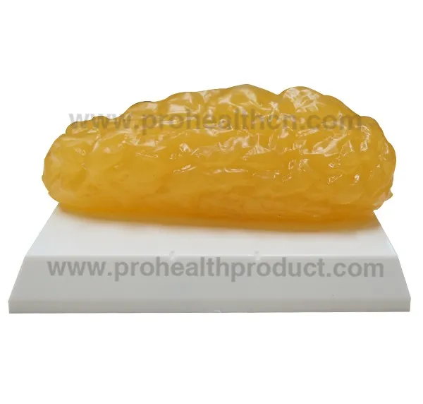 2lbs Anatomical Fat Block Replica Model - Buy Fat Blocks Model,Fat ...