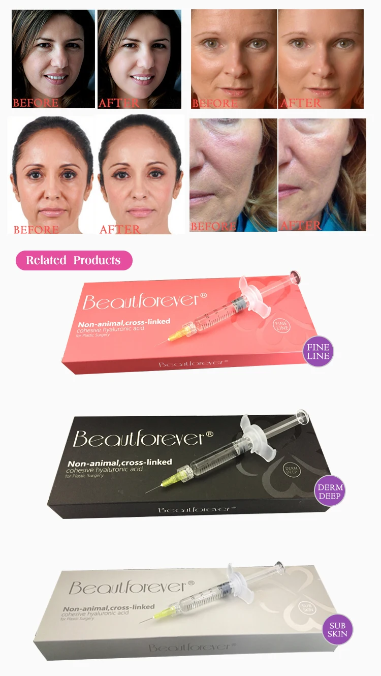 Hyaluronic acid injection dermal fillers for lip injections