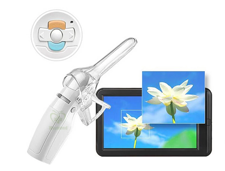 f005a-Mini Colposcope-.jpg