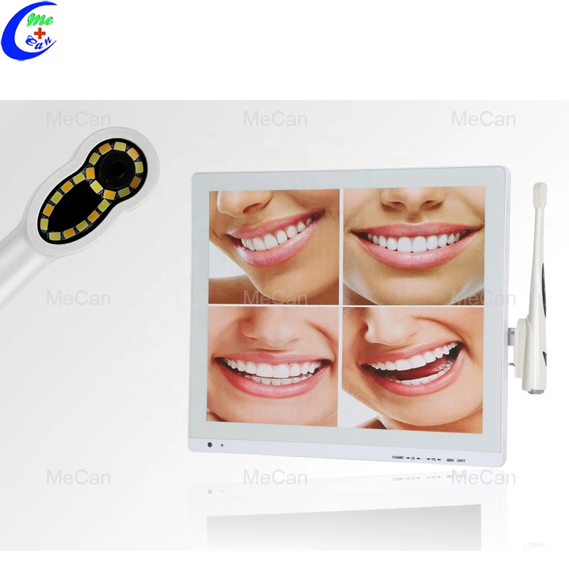 Dental Intraoral Camera