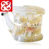 Baby teeth model / demonstration model /mix dentition with retainer