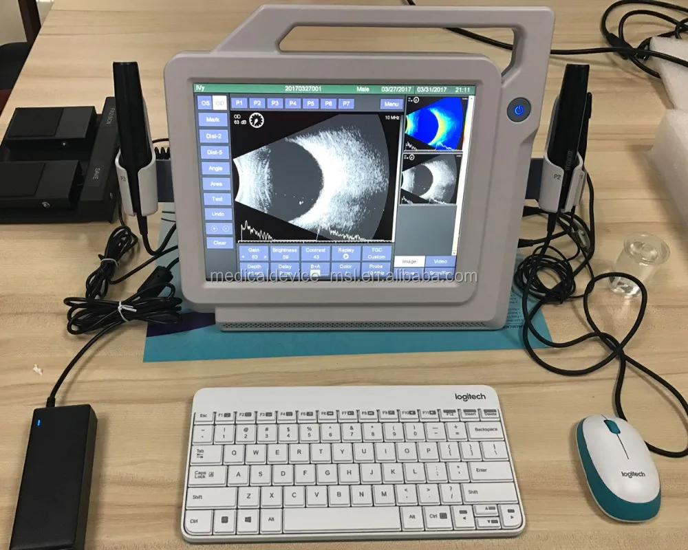 Handheld Led Touch Screen Ophthalmic A Scan And B Scan Ultrasound For