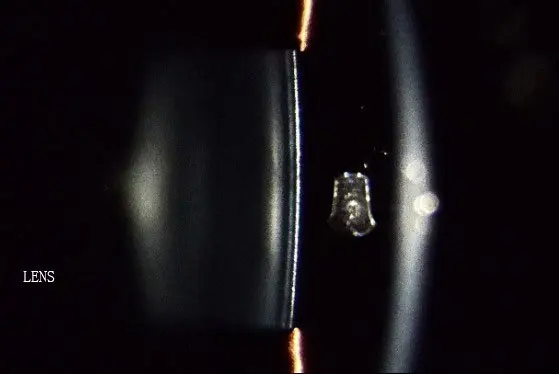 LENS.jpg