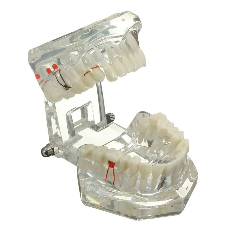 china supplier dental models