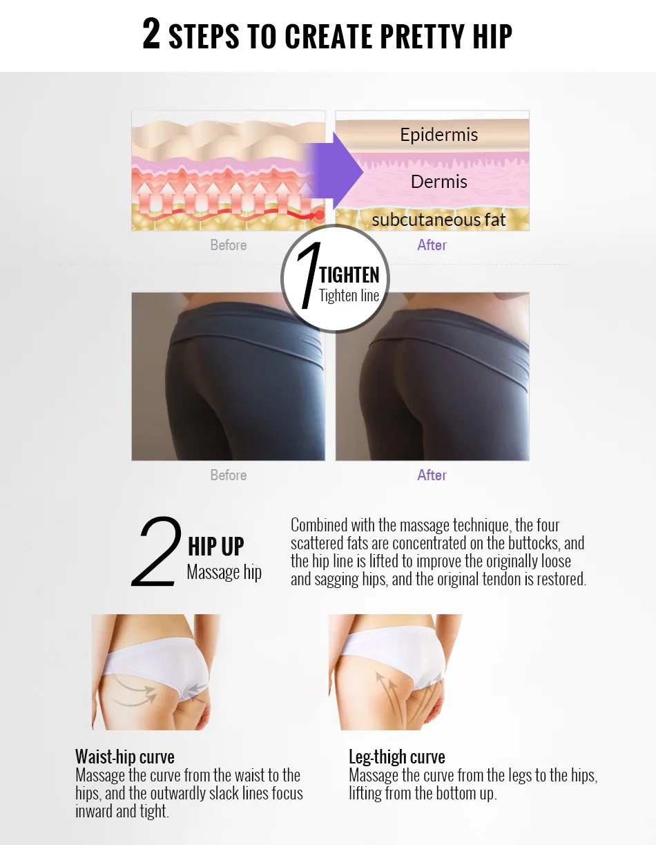 buttock enlargement (5).jpg