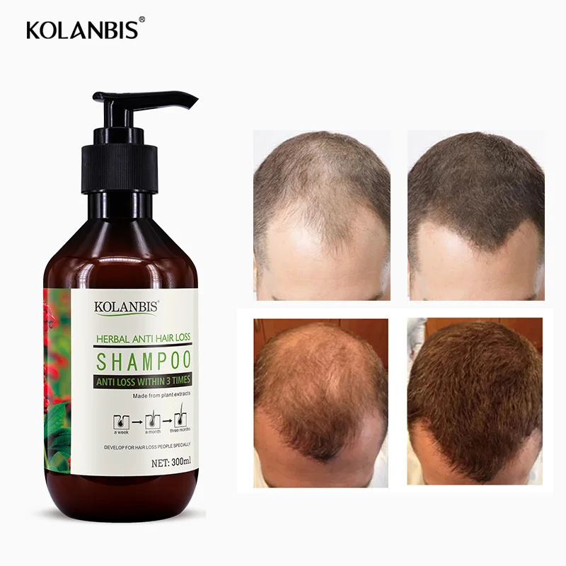 
Shampoo Hair Grow For Woman Man Hair Loss Treatment Refreshing Scalp Repair Follicle 