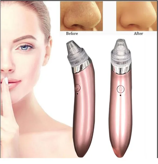 

2018 trending products nose strips vacuum suction blackhead remover vacuum, White rose gold