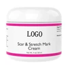 Powerful Scar & Stretch Marks Cream with Shea Butter