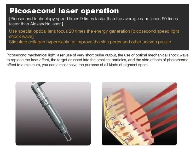 Picosecond Laser5.jpg