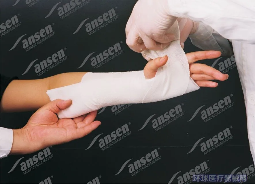 Moldable Fiberglass Posterior Long Arm Cast Splint For Fracture Bone