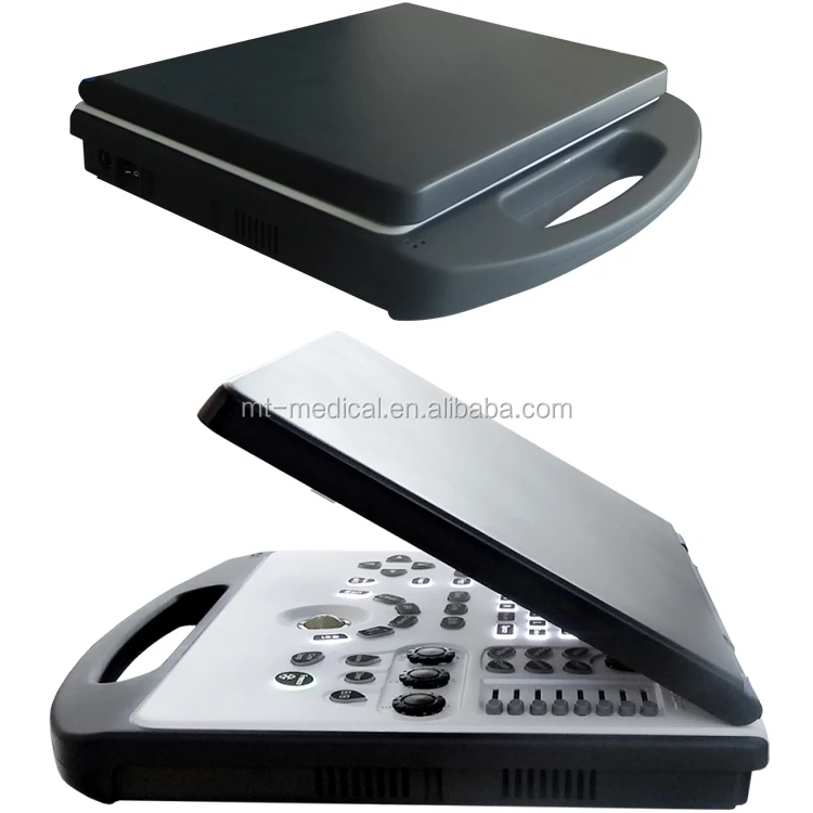 Doppler Ultrasound Equipment Type 3D/4D Portable Color Doppler Ultrasound System